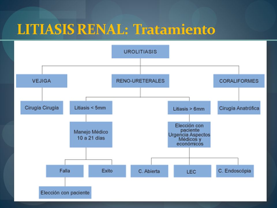 Dieta para litiasis ureteral